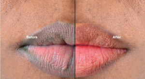 naturally ways to make your lips soft and pink